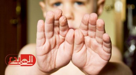 الجهاز العصبي مسئول عن تجاعيد الأصابع عند تعرضها لفترة في الماء