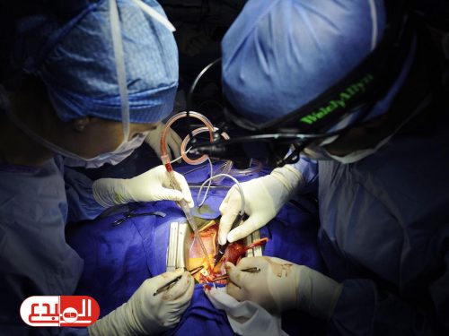 دراسة: الظهر هو الوقت الأفضل لجراحة القلب !