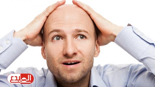 إندبندنت: اكتشاف مذهل قد يساعد في علاج الصلع