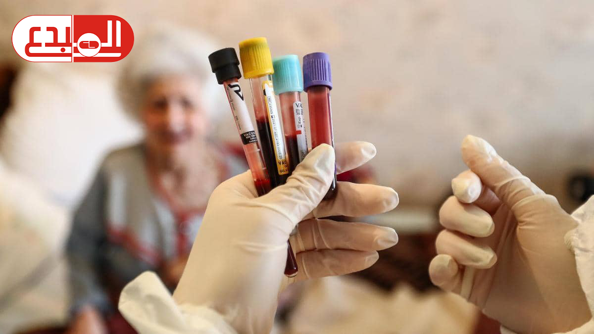 مع مخاوف لقاح أسترازينيكا.. هذه علامات الإصابة بجلطات الدم