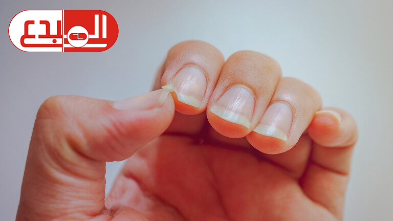 6 علامات تنذر بالخطر يجب ألا تتجاهلها أبدا على أظافرك