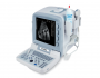 portable ultrasound US-2000