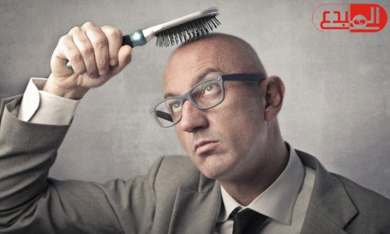 علماء يتوصلون إلى أسباب تساقط الشعر عند الرجال وراثيًا