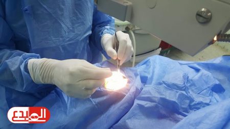 إنقاذ طفلة تعرضت لإصابة في العين بآلة حادة في مستشفى الحسين التعليمي